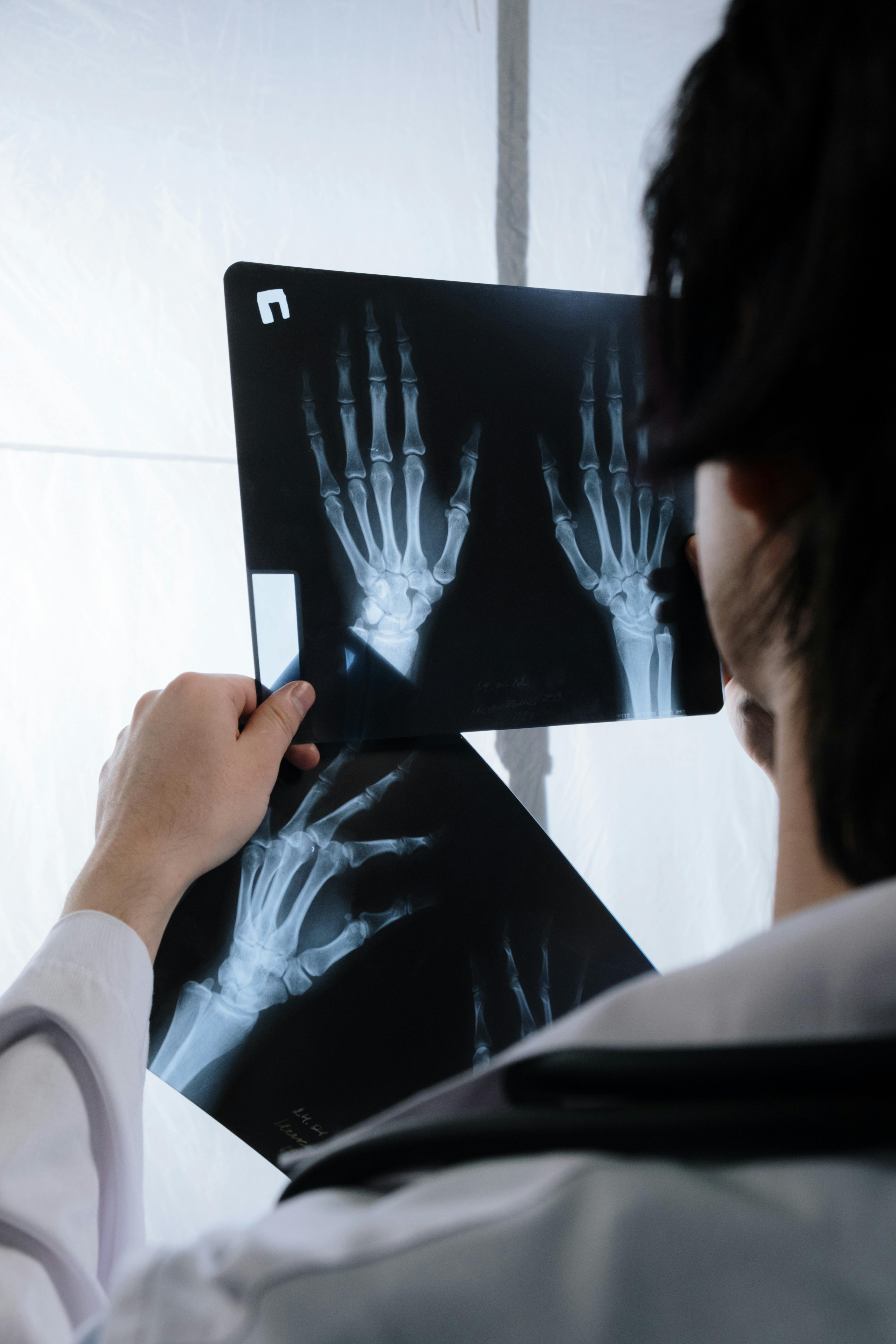 Fracture fixation physiotherapy rehabilitation